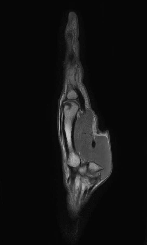 Sagittal PDw TSE mDIXON XD (In Phase)