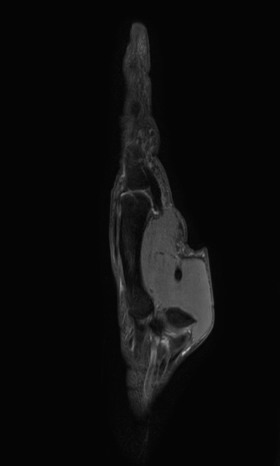 Sagittal PDw TSE mDIXON XD (Water only)