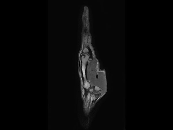 Sagittal PDw TSE mDIXON XD (In Phase)