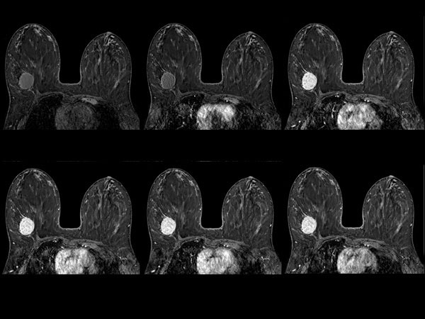 Dynamic axial eTHRIVE