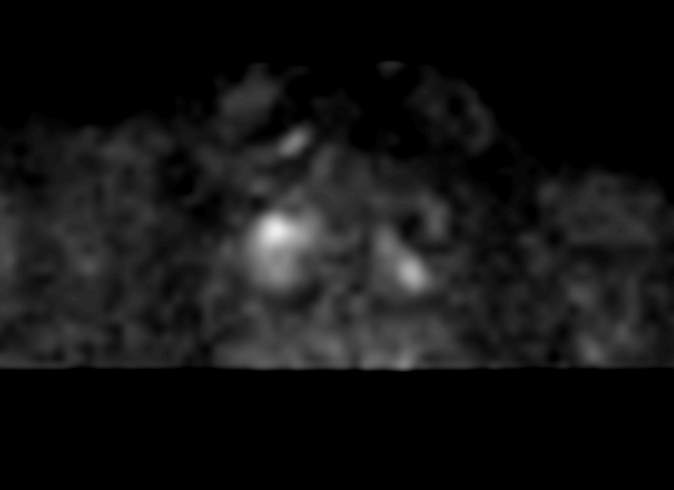 Axial Zoom Diffusion (b1500)