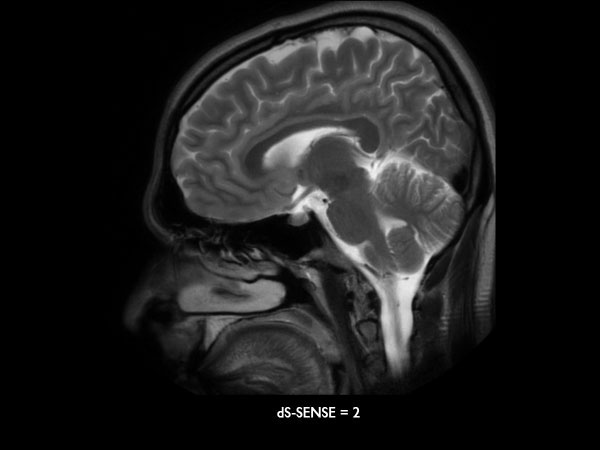 Sagittal T2w MultiVane XD