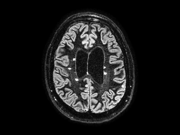 3D BrainVIEW Double IR - Axial reformat