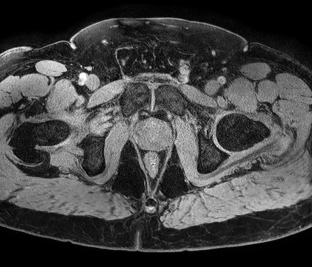 Axial eTHRIVE (high res)