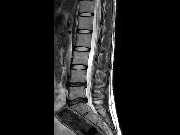 Sagittal T2w TSE