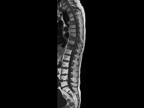 Sagittal T1w TSE