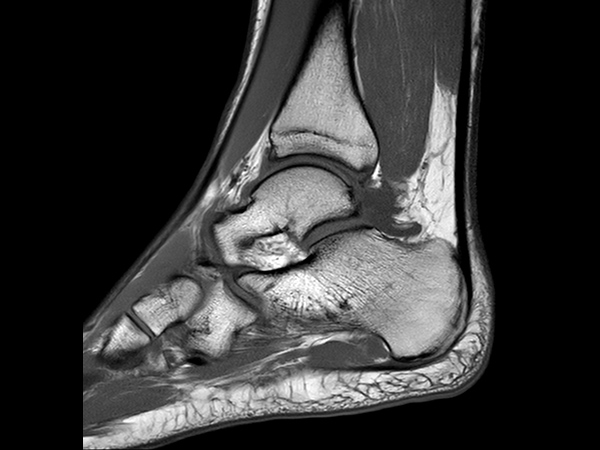 Sagittal T1w TSE 