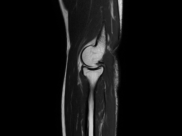 Sagittal T2w TSE