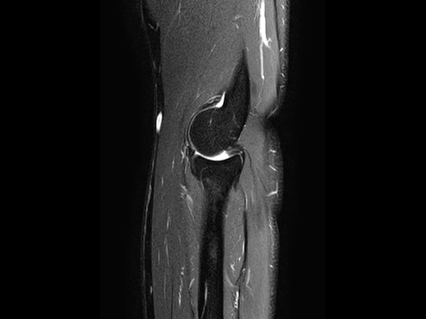 Sagittal T2w SPIR