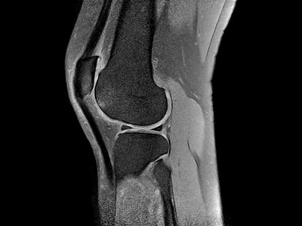 Sagittal T1w SPIR<b>Post-gado</b>