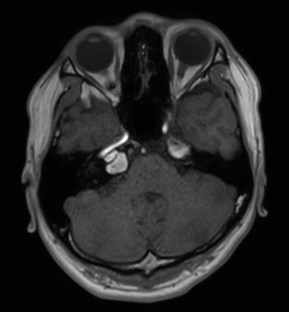 T1w FFE mDIXON XD (In Phase)