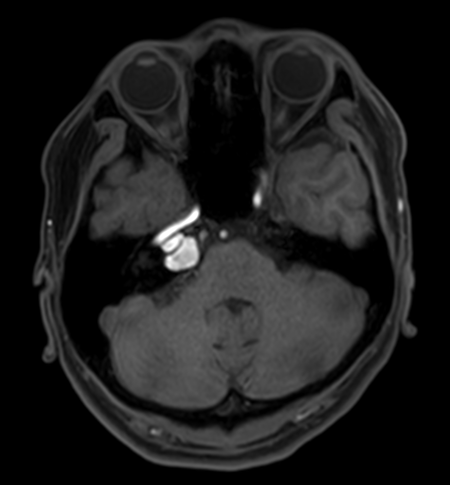 T1w FFE mDIXON XD (Water only)