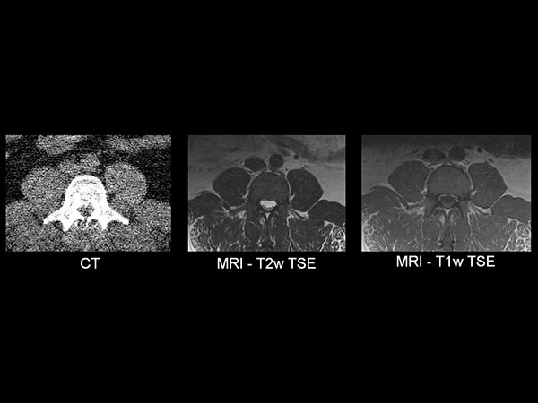 CT vs MRI