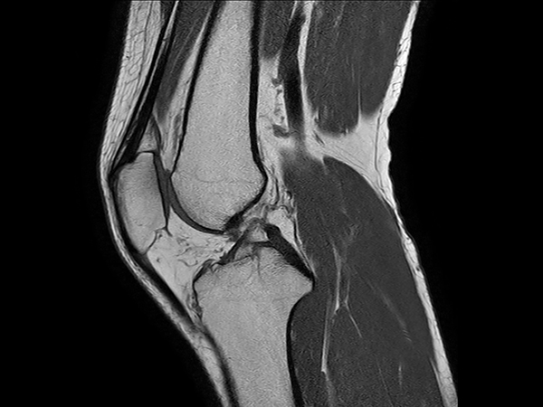 Sagittal T1w TSE