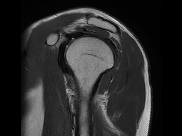 Sagittal T2w TSE