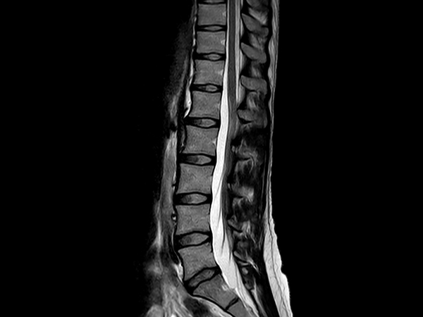 Sagittal T2w TSE