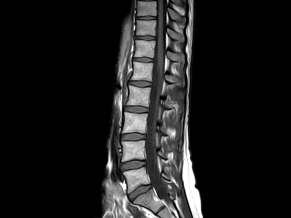 Sagittal T1w TSE