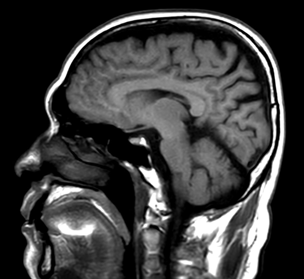 T1w SE - Compressed SENSE