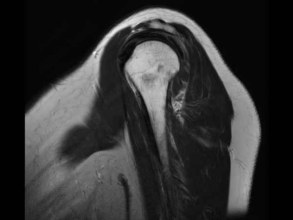 Sagittal T2w TSE