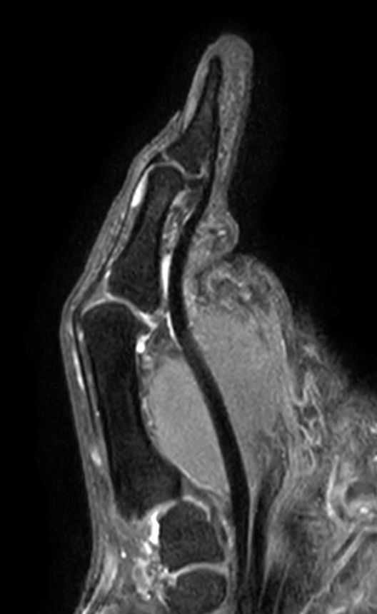 PDw TSE mDIXON XD (Water only)