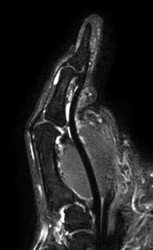 T2w TSE mDIXON XD (Water only)