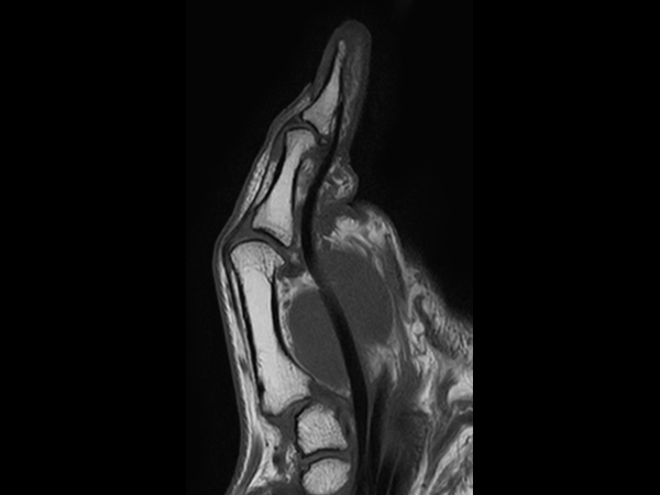 Sagittal T1w TSE