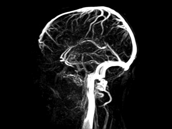 Sagittal 4D-TRAK XD