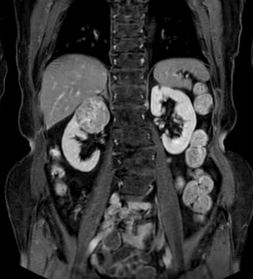 T1w mDIXON XD FFE with gado (Water only)