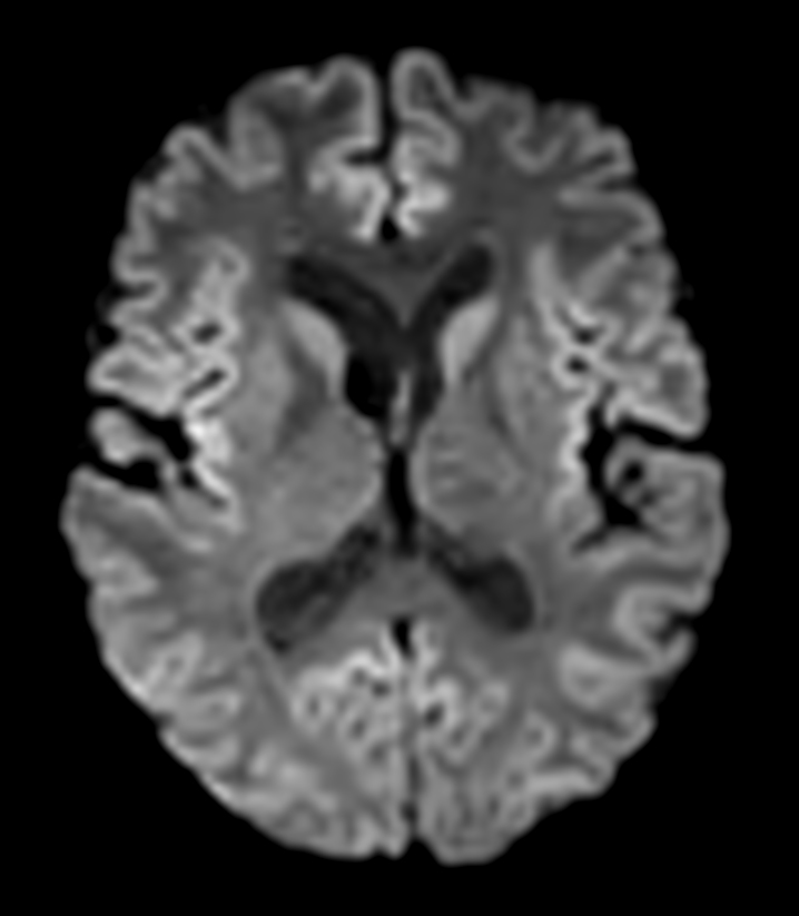 DTI b800 15 directions