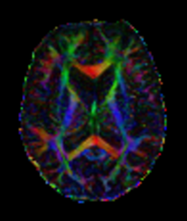 DTI b800 MultiBand SENSE 32 directions (FA map)