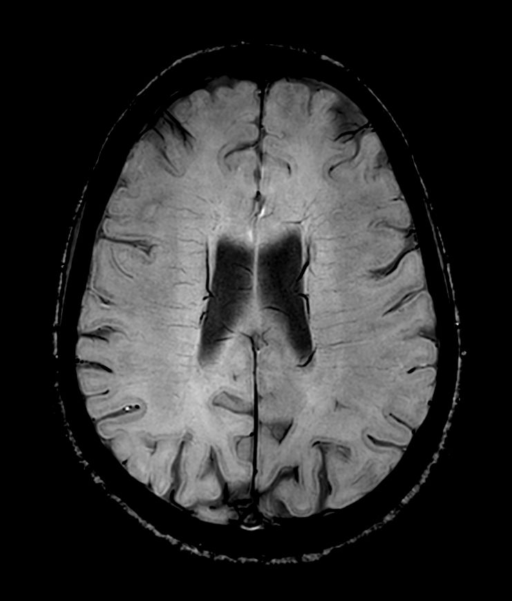 SWIp 4 echoes (Modulus)