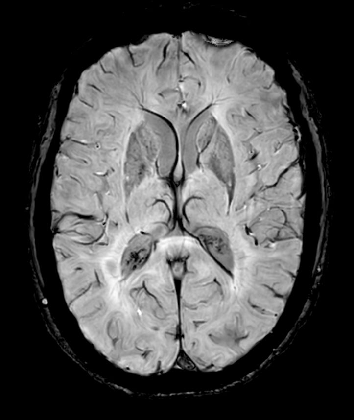 SWIp 6 echoes (Modulus)