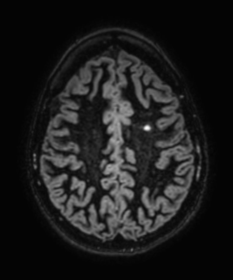 3D Double IR (reformat)
