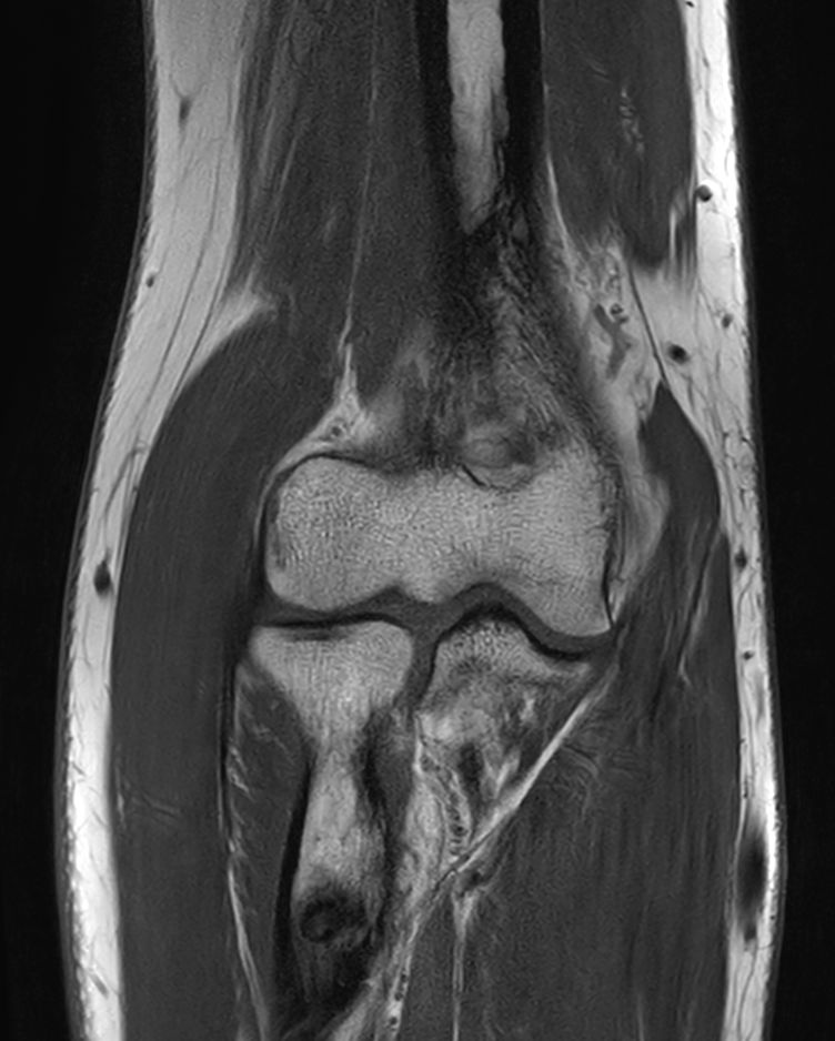 T1w TSE <b>Compressed SENSE</b>
