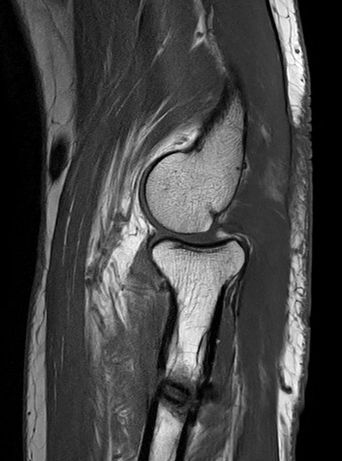 T1w TSE <b>Compressed SENSE</b>