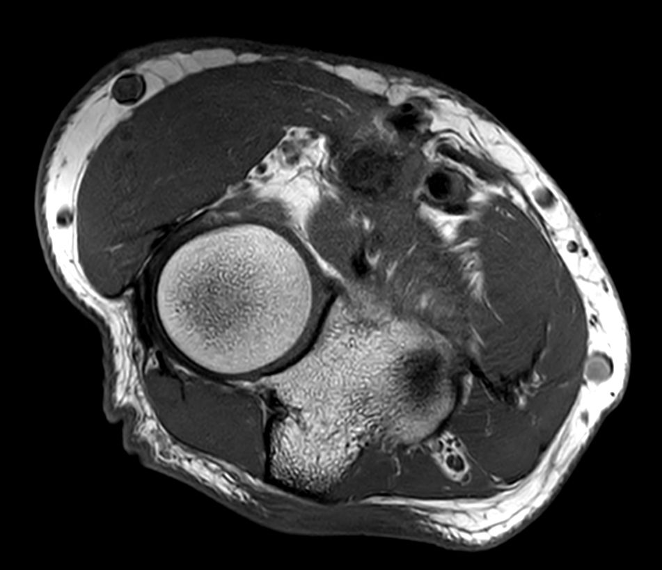 T1w TSE <b>Compressed SENSE</b>