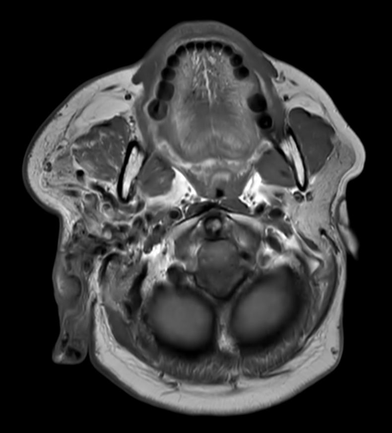 T1w TSE <b>Compressed SENSE</b>