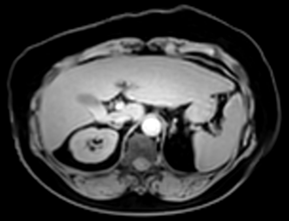 mDIXON XD Quant (Water only)