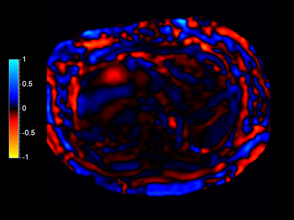 MR Elastography (SE-EPI, 4 slices)