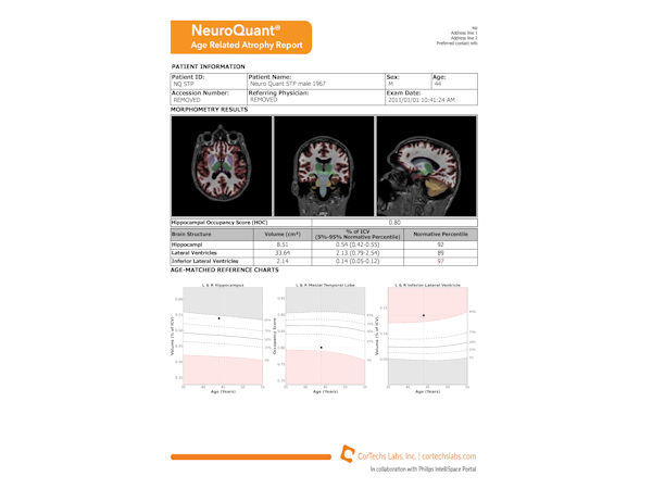 NeuroQuant - Age related atrophy report