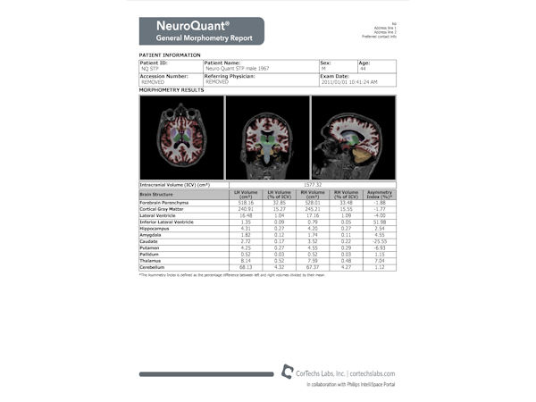 NeuroQuant - Morphology report