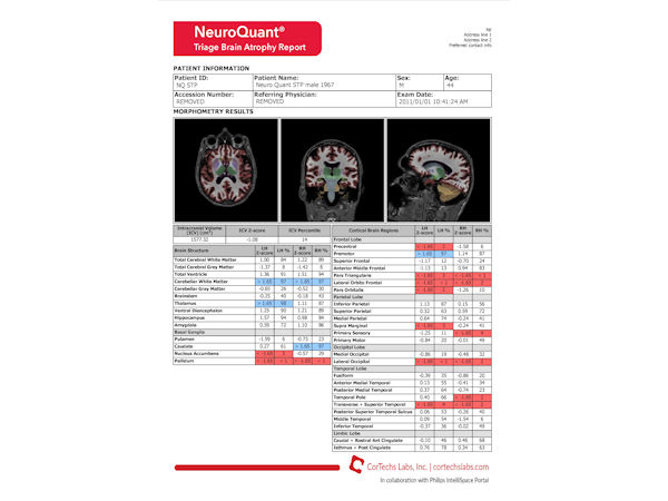 NeuroQuant - Triage brain atrophy