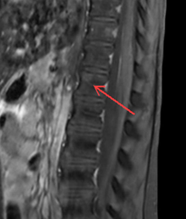 Sagittal T1w TSE SPIR