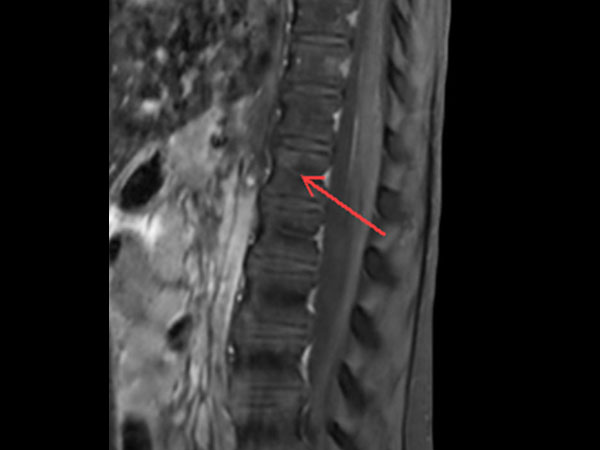 Sagittal T1w TSE SPIR