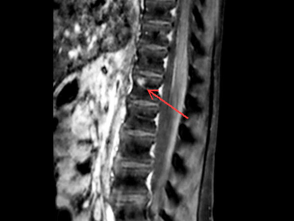 Sagittal T1w mDIXON TSE