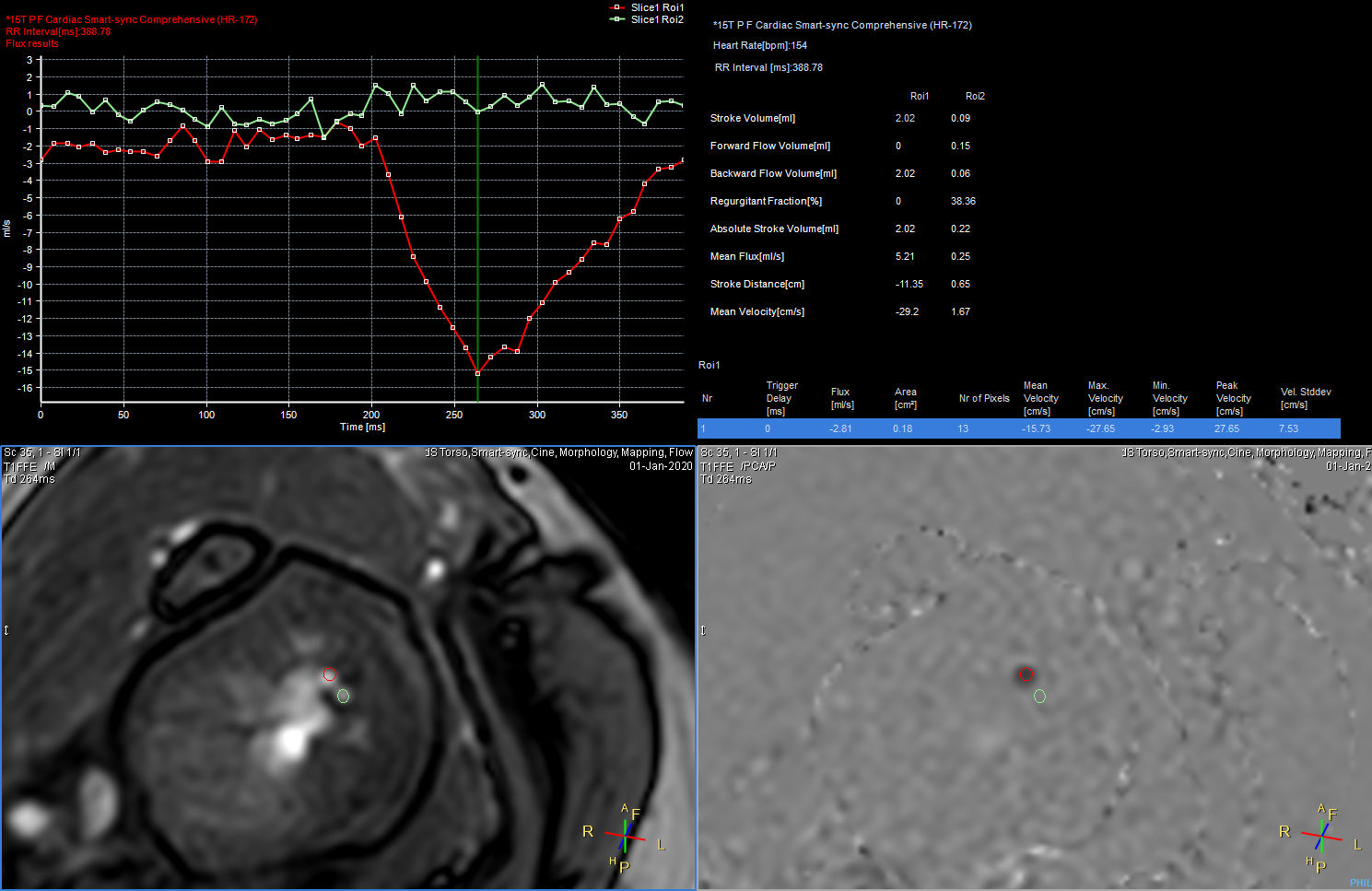 Qflow analysis