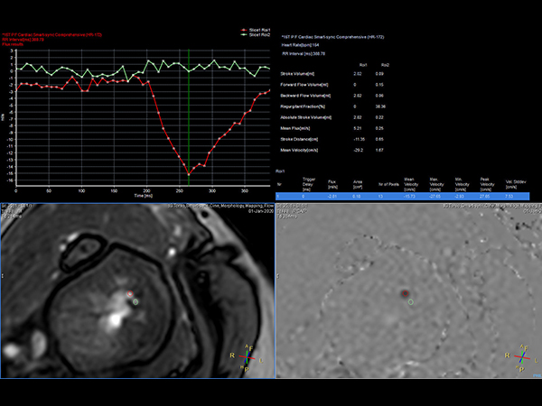 Qflow analysis