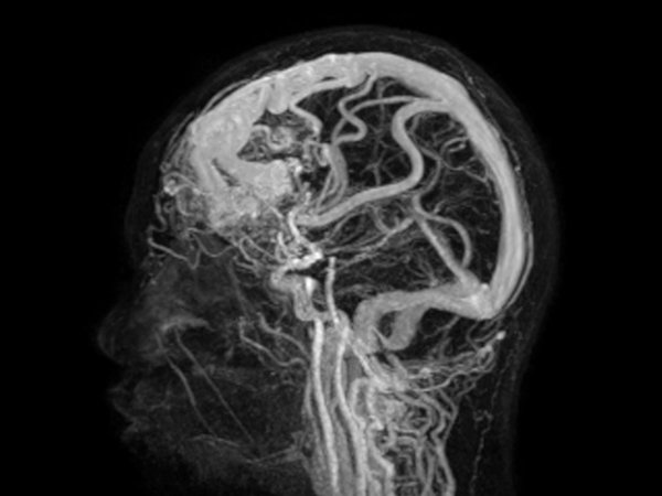 Sagittal 4D-TRAK XD