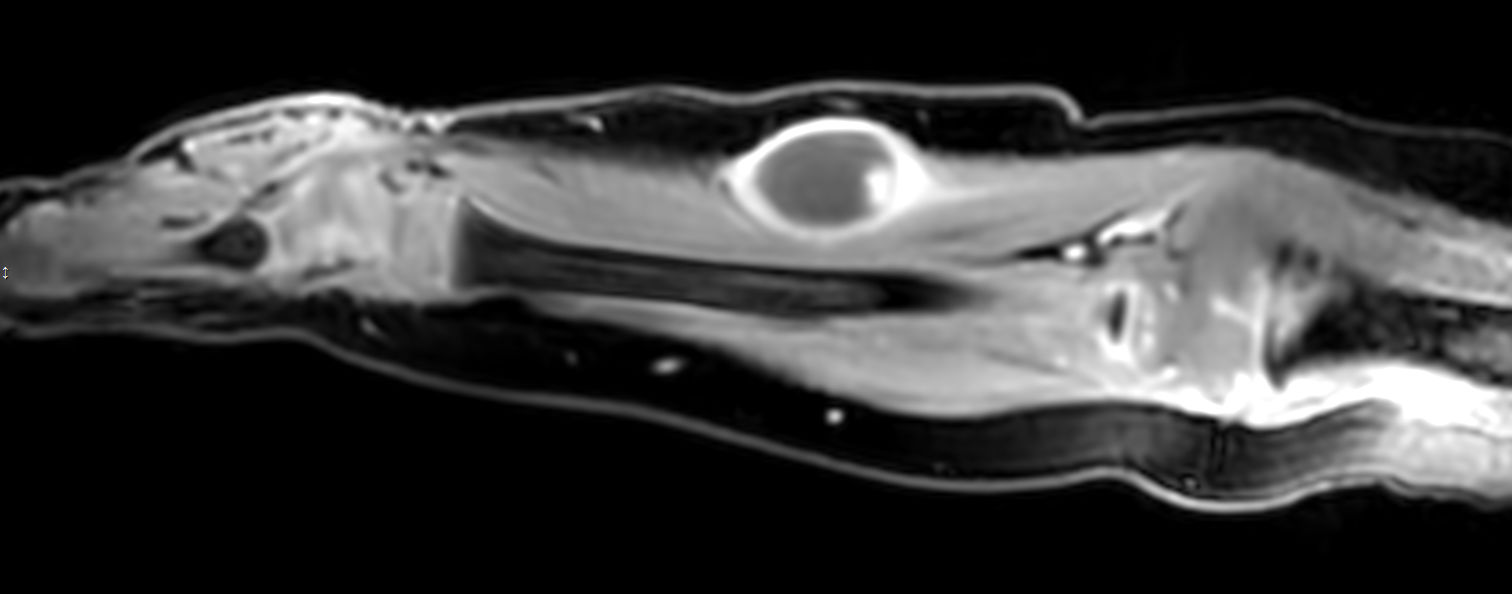 Sagittal 3D eTHRIVE +gado