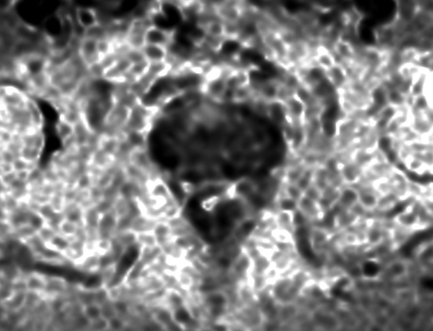 Axial Diffusion (eADC)